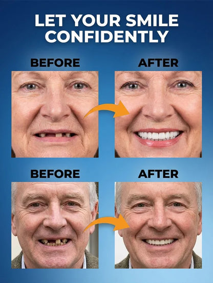 New generation of customized full-function dentures-LUN