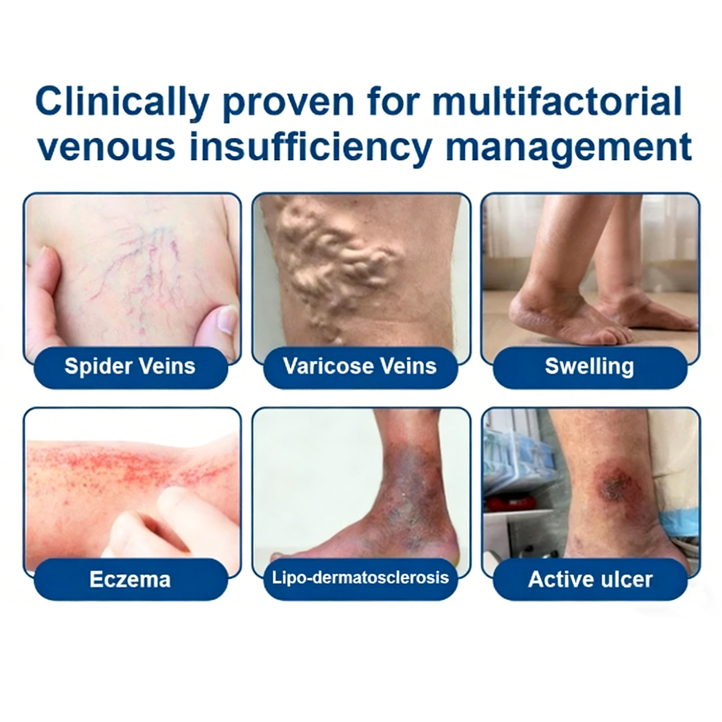 🌿 Hgfnvllc® Vein Contour Micro-Patch ✨ Diosmin & Hesperidin Leg Care Support-LUN