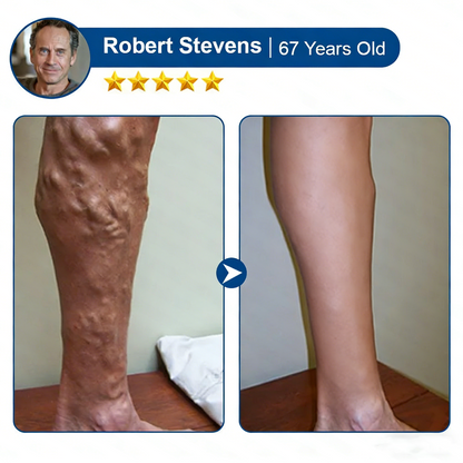 🌿 Hgfnvllc® Vein Contour Micro-Patch ✨ Diosmin & Hesperidin Leg Care Support-LUN