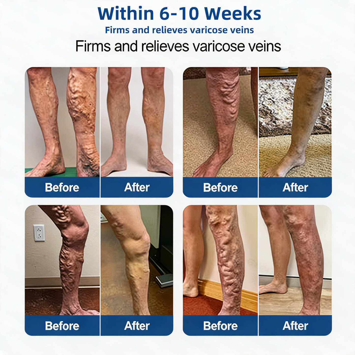 🌿 Hgfnvllc® Vein Contour Micro-Patch ✨ Diosmin & Hesperidin Leg Care Support-LUN