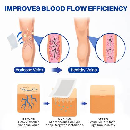 🌿 Hgfnvllc® Vein Contour Micro-Patch ✨ Diosmin & Hesperidin Leg Care Support-LUN