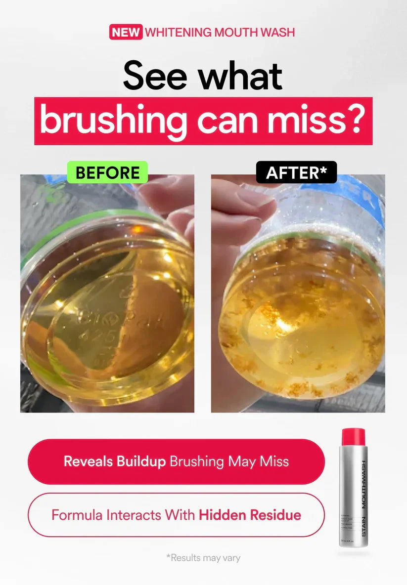 ✨Skavix Whitening Mouthwash – Stain Removal, Brighter Teeth & Fresh Breath-LUN