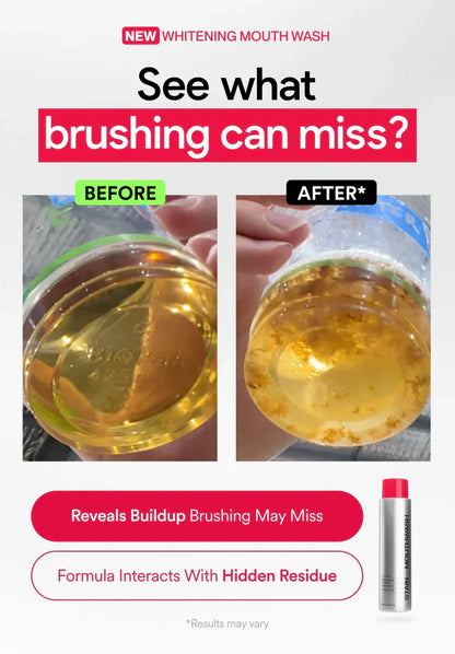 ✨Skavix Whitening Mouthwash – Stain Removal, Brighter Teeth & Fresh Breath-LUN