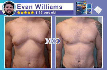 ⚕️💙Hgfnvllc® Gynecomastia Chest Fatburn & Firm Patch-LUN